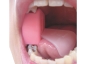 Preview: "Mouth Prop" Beissblock mit Zungenhalter, Größe L
