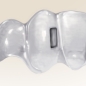 Preview: Ortho Clear Collection - The Vertical-Zange