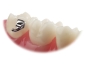 Preview: VIPER™, Bondable buccal tube, Mini (tooth 27, 47), .022", Torque -14°, Offset 0°
