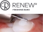 Preview: Renew™ System - Finierer Nr. 118L