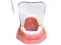 Preview: Chrome-plated glas mirror, occlusal (child)