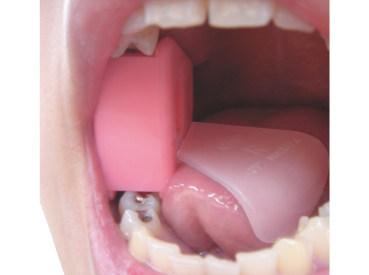 "Mouth Prop" Beissblock mit Zungenhalter, Größe S