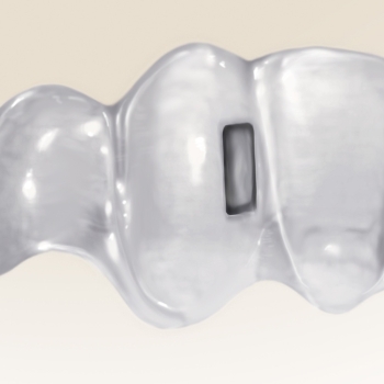 Ortho Clear Collection - The Vertical