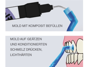 Reliamold™, Knöpfchen-Attachment