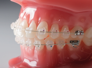 G4  Ultraesthetic™ (tooth colour) Nickel Titanium SE , Reverse Curve, ROUND