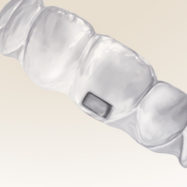 Ortho Clear Collection - The Horizontal-Zange