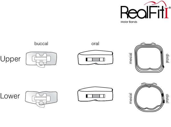RealFit™ I - Intro-Kit, UK, Zweifach-Kombination inkl. Lip Bumper-Tube + lin. Schloß (Zahn 46, 36) MBT* .022"